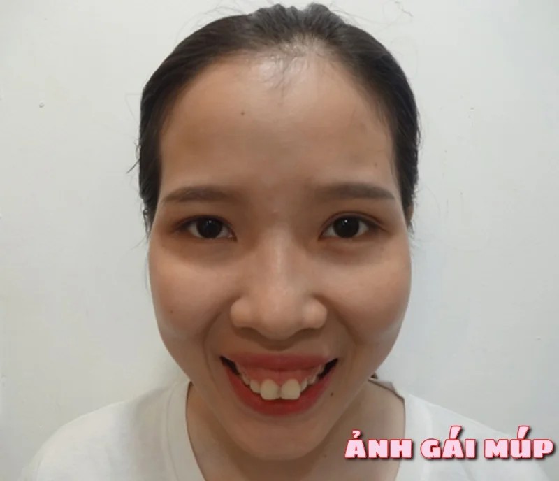 Ảnh gái xấu tổng kết