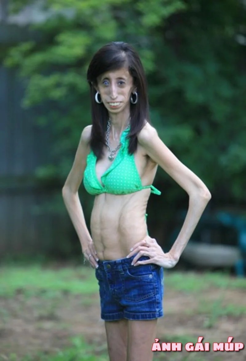 Lizzie Velasquez - Cô gái xấu nhất thế giới