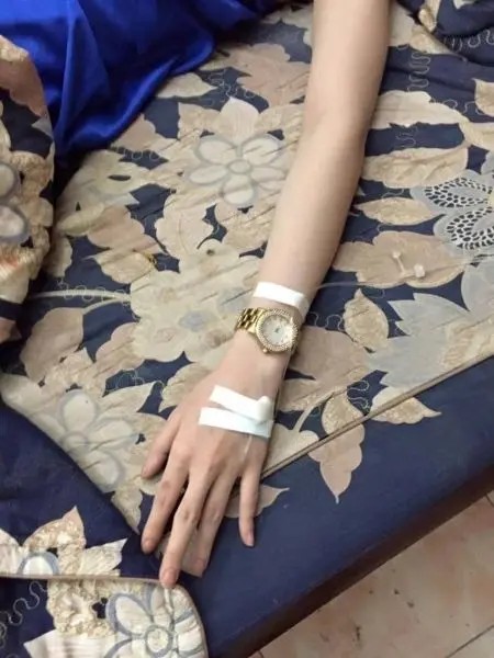 Truyền nước ở tay nữ với ánh sáng tự nhiên nhẹ nhàng